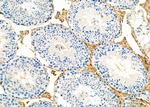 TIMM44 Antibody in Immunohistochemistry (Paraffin) (IHC (P))