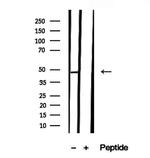 TIMM44 Antibody in Western Blot (WB)