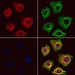 TRBP Antibody in Immunocytochemistry (ICC/IF)