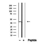 SLC22A12 Antibody in Western Blot (WB)