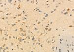 ALP Antibody in Immunohistochemistry (Paraffin) (IHC (P))