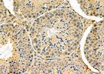 CXCL14 Antibody in Immunohistochemistry (Paraffin) (IHC (P))