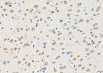 CXCL14 Antibody in Immunohistochemistry (Paraffin) (IHC (P))