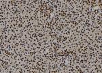 E2F3 Antibody in Immunohistochemistry (Paraffin) (IHC (P))