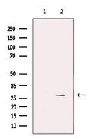 GSTM3 Antibody in Western Blot (WB)