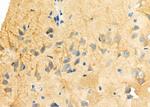 MAP1B Antibody in Immunohistochemistry (Paraffin) (IHC (P))