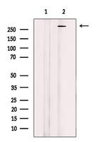 MAP1B Antibody in Western Blot (WB)