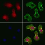 PHF17 Antibody in Immunocytochemistry (ICC/IF)