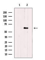 PHF17 Antibody in Western Blot (WB)