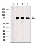 PHF17 Antibody in Western Blot (WB)