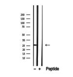 SAT1 Antibody in Western Blot (WB)