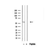 SLC13A2 Antibody in Western Blot (WB)