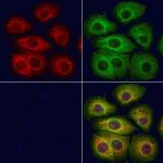 TCTN2 Antibody in Immunocytochemistry (ICC/IF)