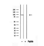 TCTN2 Antibody in Western Blot (WB)