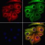 VPS11 Antibody in Immunocytochemistry (ICC/IF)