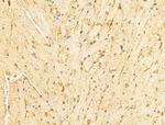 VPS11 Antibody in Immunohistochemistry (Paraffin) (IHC (P))