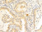 WWP1 Antibody in Immunohistochemistry (Paraffin) (IHC (P))