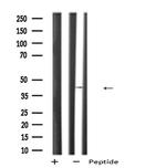 PDHA2 Antibody in Western Blot (WB)