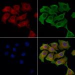 PRKAR2A Antibody in Immunocytochemistry (ICC/IF)