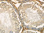 PRKAR2A Antibody in Immunohistochemistry (Paraffin) (IHC (P))