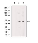 PRKAR2A Antibody in Western Blot (WB)