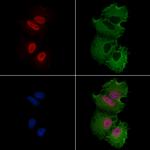 ATF7 Antibody in Immunocytochemistry (ICC/IF)