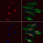 ATF7 Antibody in Immunocytochemistry (ICC/IF)