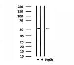 ATF7 Antibody in Western Blot (WB)