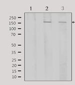 ATF7 Antibody in Western Blot (WB)