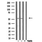 ATF7 Antibody in Western Blot (WB)