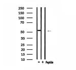 PKA beta Antibody in Western Blot (WB)