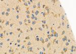 PKA beta Antibody in Immunohistochemistry (Paraffin) (IHC (P))