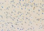 PKA beta Antibody in Immunohistochemistry (Paraffin) (IHC (P))