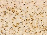 TEAD1 Antibody in Immunohistochemistry (Paraffin) (IHC (P))