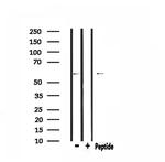 GTF2H1 Antibody in Western Blot (WB)