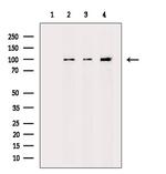 alpha Actinin 2/3 Antibody in Western Blot (WB)