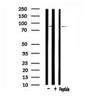 SOX6 Antibody in Western Blot (WB)