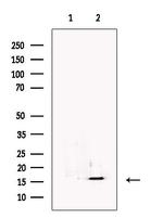 RBP5 Antibody in Western Blot (WB)