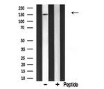 CHAF1A Antibody in Western Blot (WB)