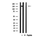 CHAF1A Antibody in Western Blot (WB)