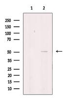 ITPK1 Antibody in Western Blot (WB)