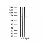 ADCK5 Antibody in Western Blot (WB)