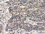 SLC22A18 Antibody in Immunohistochemistry (Paraffin) (IHC (P))