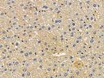 SLC22A18 Antibody in Immunohistochemistry (Paraffin) (IHC (P))