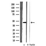 SLC22A18 Antibody in Western Blot (WB)