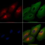 DUSP9 Antibody in Immunocytochemistry (ICC/IF)