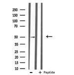 AZI2 Antibody in Western Blot (WB)