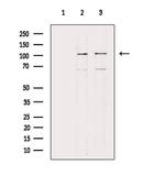 COL6A2 Antibody in Western Blot (WB)