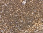 MLH3 Antibody in Immunohistochemistry (Paraffin) (IHC (P))