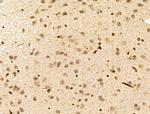 MLH3 Antibody in Immunohistochemistry (Paraffin) (IHC (P))